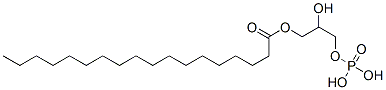 2-HYDROXY-3-(PHOSPHONOOXY)PROPYL STEARATE 結(jié)構(gòu)式