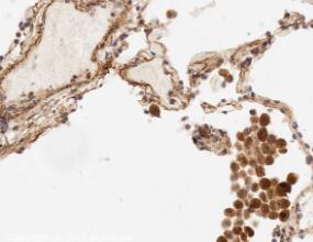 Immunohistochemistry (Formalin/PFA-fixed paraffin-embedded sections) - Anti-IL-6 antibody (ab6672)