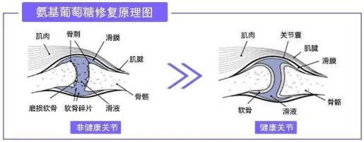 氨基葡萄糖是“硫酸”的好還是“鹽酸”的好？