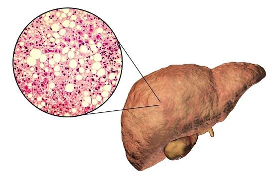 Semaglutide.jpg