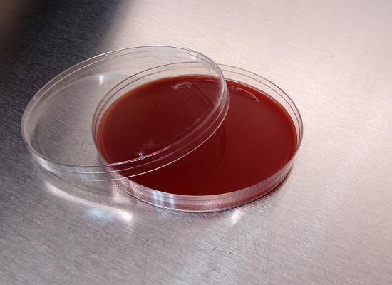 Figure 1. Agar.png