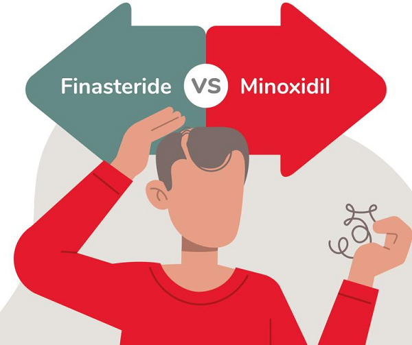 Finasteride