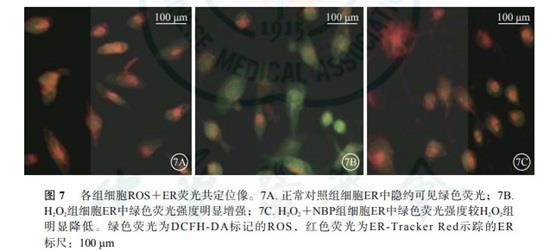 2',7'-二氯熒光素二乙酸酯的應(yīng)用-5.jpg