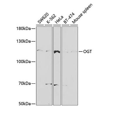 OGT抗體的應用