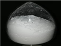 Carbasalate Calcium