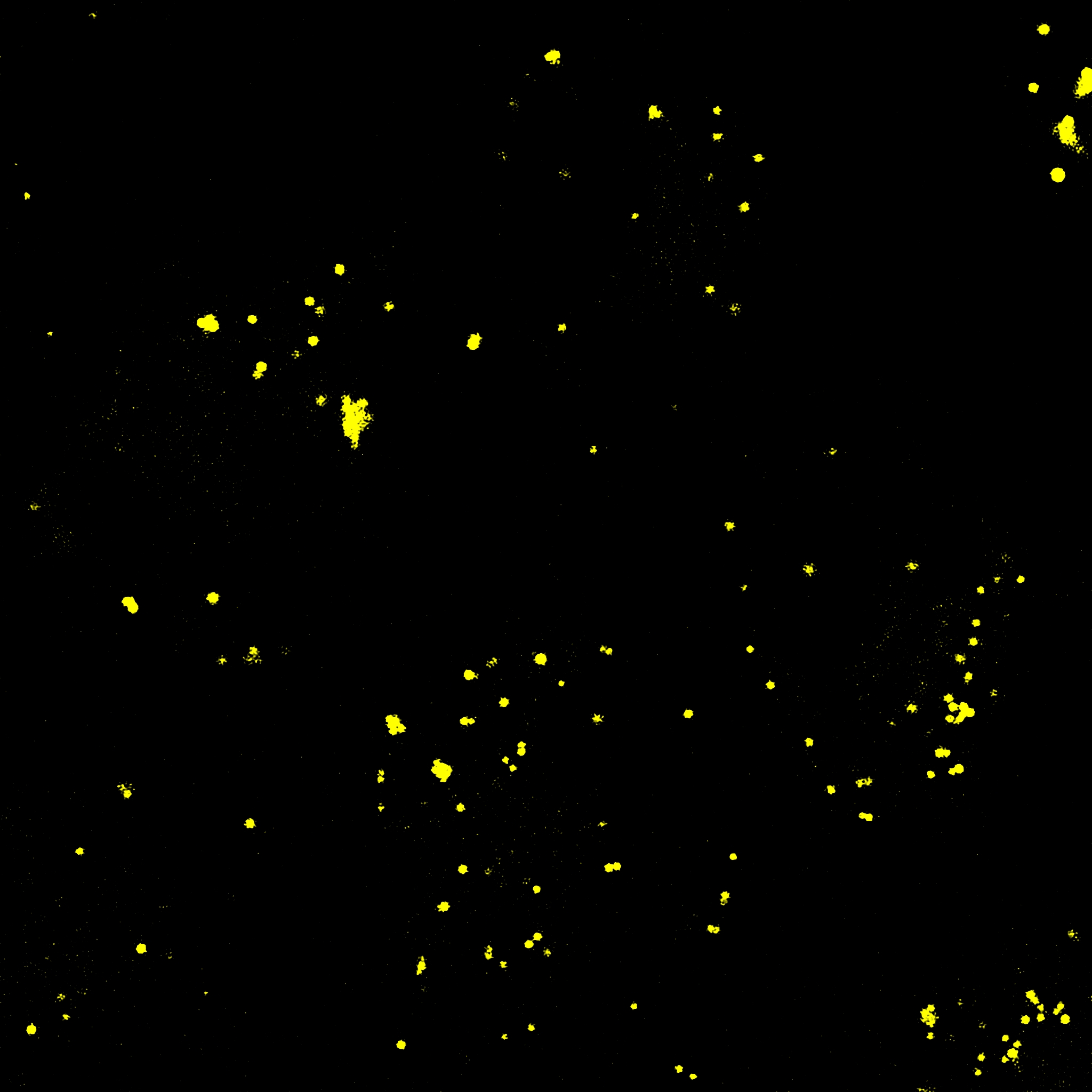 AIE Yellow Probe for Lipid droplets