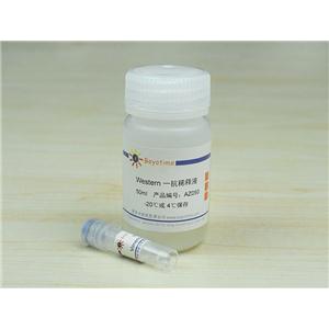 Vimentin Mouse Monoclonal Antibody