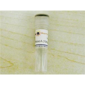 RNase A (10mg/ml, DNase free)