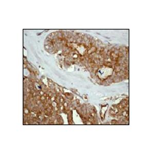 RADIXIN 兔單克隆抗體