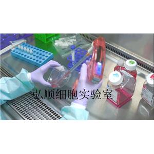 NCI-H660 Cell；人小細胞癌細胞