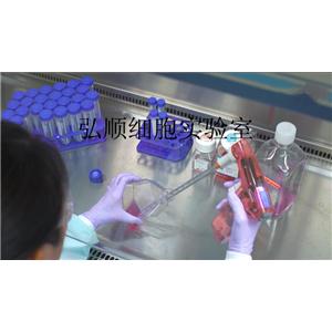 RPMI-8402細(xì)胞系|人急性T淋巴細(xì)胞白血病細(xì)胞系