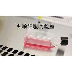 Tca-83細(xì)胞系|人口腔鱗癌細(xì)胞系