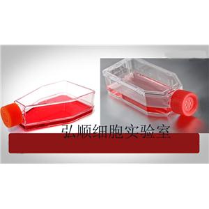 SUP-B15 Cell<人Ph+急淋白血病細(xì)胞系>