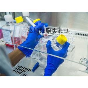 HuT 102 Cell<人T淋巴瘤細(xì)胞系>
