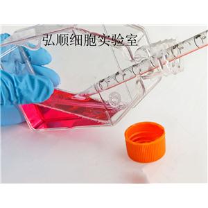 UMUC-14 Cell<人腎癌細(xì)胞系>