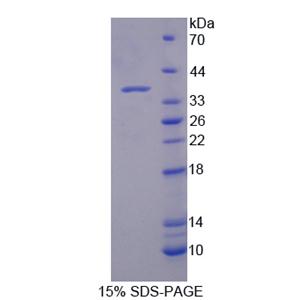 214kDa核孔蛋白(NUP214)重組蛋白