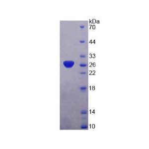 25kDa突觸關(guān)聯(lián)蛋白(SNAP25)重組蛋白
