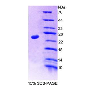 35kDa核孔蛋白(NUP35)重組蛋白