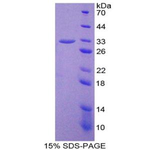 37kDa核孔蛋白(NUP37)重組蛋白