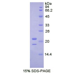 43kDa Tar DNA結(jié)合蛋白(TDP43)重組蛋白