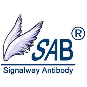 DCP2 Antibody