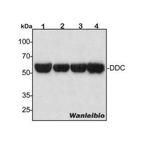 DOPA Decarboxylase