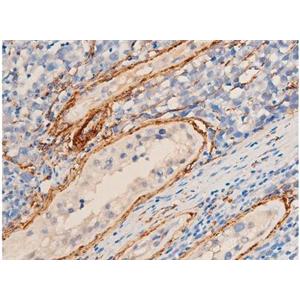 BDH1 antibody