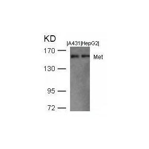 c-Met antibody