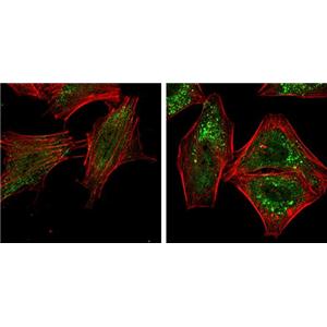 ATG5 antibody