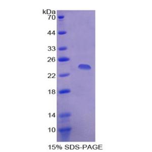 血清淀粉樣P物質(zhì)(SAP)重組蛋白