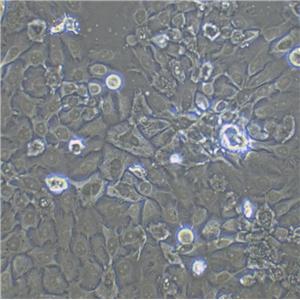 NCI-H508 Cell:人結(jié)腸直腸腺癌細(xì)胞系