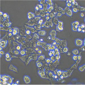 RKO Cell:人結(jié)腸癌細(xì)胞系