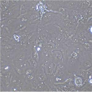 NCI-H446 Cell:人小細(xì)胞肺癌細(xì)胞系