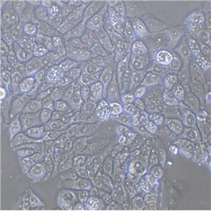 SK-MES-1 Cell:人肺鱗癌細(xì)胞系