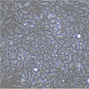 NCI-H1755 Cell:人肺癌細(xì)胞系