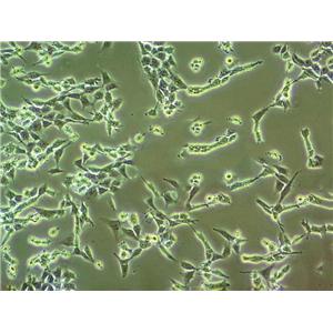 M619 Cell:人侵襲性脈絡膜黑色素瘤細胞系