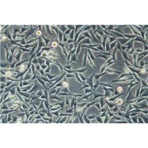 OCM-1A Cell:人脈絡(luò)膜黑色素瘤細(xì)胞系