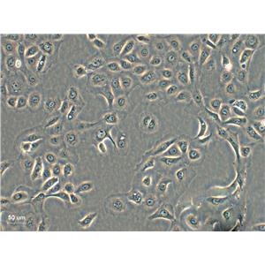 LAPC-4 Cell:人前列腺癌細(xì)胞系