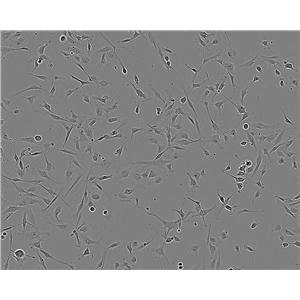 hTERT-RPE1 Adherent人視網(wǎng)膜色素上皮細(xì)胞系