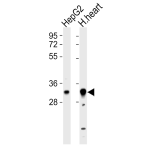 Anti-HCCS antibody produced in rabbit