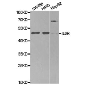 兔抗IL6R多克隆抗體