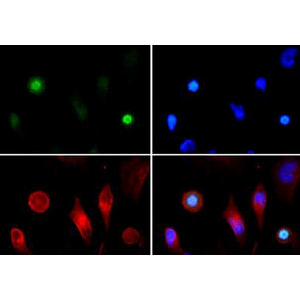 ANTI-HISTONE H3 (PHOSPHO T3,ACETYL K4)抗體