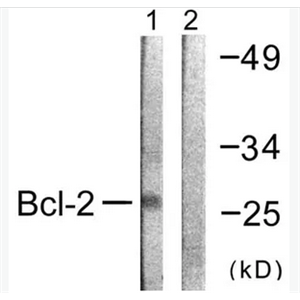 ANTI-BCL-2抗體