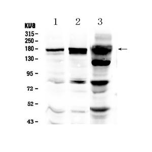 Anti-EGFR Antibody