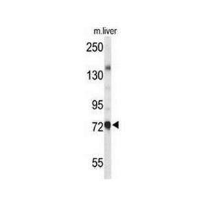 ANTI-CHOLINE ACETYLTRANSFERASE