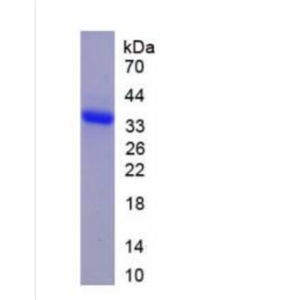 Wolfram綜合征蛋白1(WFS1)重組蛋白