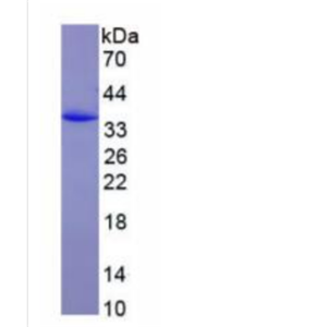 含卷曲螺旋C2域蛋白1A(CC2D1A)重組蛋白