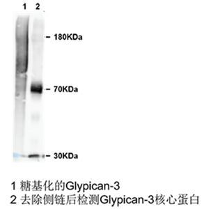 glypican 3小鼠單抗；Anti-Glypican 3 antibody; GPC3 