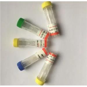 Cyclin D1  Antibody