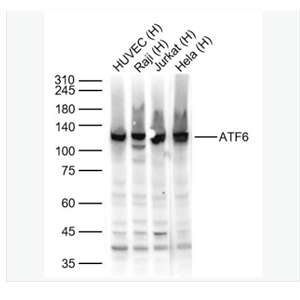 ATF6 antibody-活化轉(zhuǎn)錄因子6抗體